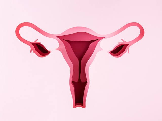 Endometriozis (Çikolata Kisti)
