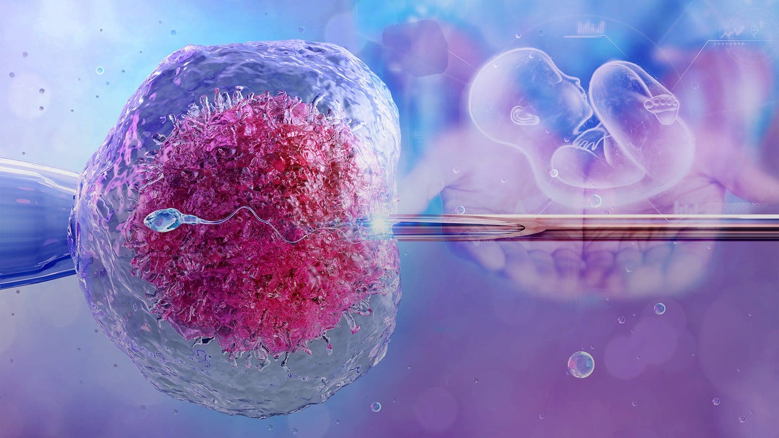 Tüp Bebek (IVF)